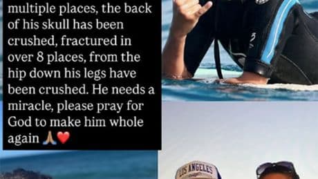 Surfing legend’s 20-year-old son ‘fighting for his life’ after being pinned between cars in devastating accident