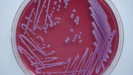 Une étrange infection bactérienne fait deux morts aux États-Unis, elle aurait été activée par l'ouragan Hélène