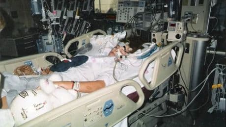 ‘I was the first person to survive rabies without a vaccination’
