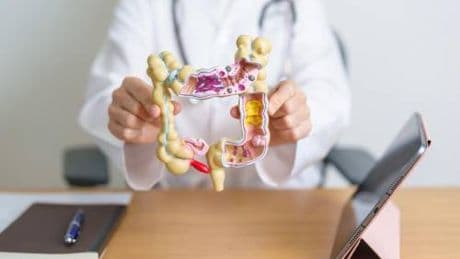 Cancro metastatico colon retto, campagna 'Più cura. Più tempo. Più vita'