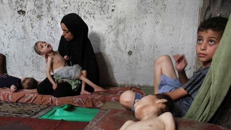 Guerre à Gaza : un quart des enfants de moins de 5 ans souffrent de malnutrition, dénonce MSF