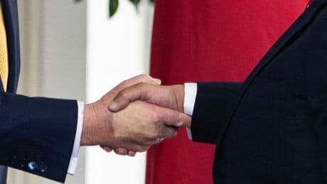 Dalle caviglie gonfie ai lividi sulle mani: ecco cos'è l'insufficienza venosa e perché Trump ne soffre