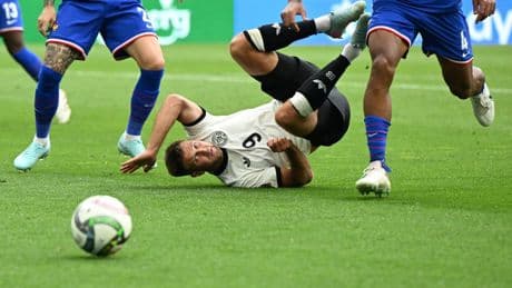 DFB-Team in Not: Nagelsmanns offene Baustellen