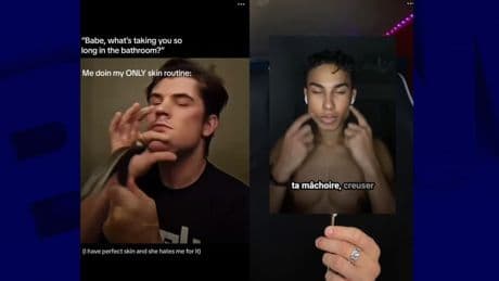 Se taper le visage au marteau, chirurgie, stéroïdes... L'inquiétante tendance "Looksmaxxing" qui cartonne sur Tiktok