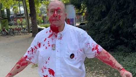 Frankfurt - Farb-Attacke auf Juden im Park