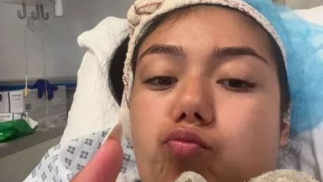 Brit tourist 'almost loses ear' as pus pours from spider bite in horror scenes