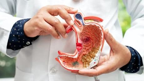 La OMS alerta sobre la bacteria 'Helicobacter pylori': causará más de 11 millones de casos de cáncer gástrico en el mundo