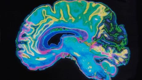 'Cheap' weekly activity 'slows down' brain ageing and may cut dementia risk