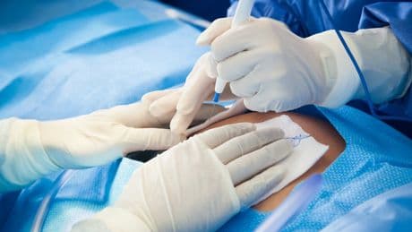 Researchers warn planned C-section births — the most common surgery in the US — can increase risk of childhood cancers