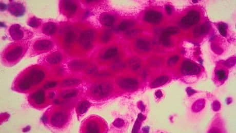 Warning after cancer patients died following delays in getting life-saving emergency drugs