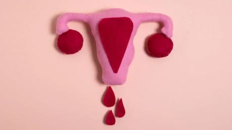 ¿Cuáles son las causas del sangrado menstrual abundante?
