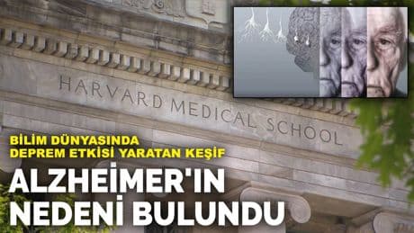 Bilim dünyasında deprem etkisi yaratan keşif: Alzheimer'ın nedeni bulundu