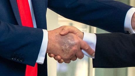 Erneuter Bluterguss an der Hand: Wie steht es um die Gesundheit von Trump?