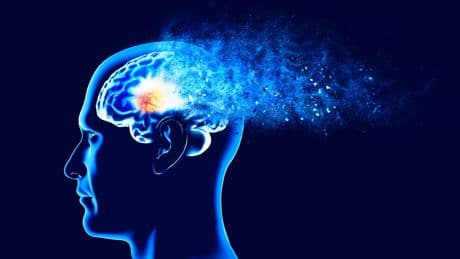 Neue deutsche Studie - Schallwellen bringen Alzheimer zum Stillstand