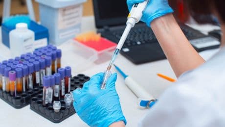 HIV tedavisinde yeni bir yöntem geliştirildi