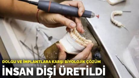 Dolgu ve implantlara karşı biyolojik çözüm: İnsan dişi üretildi
