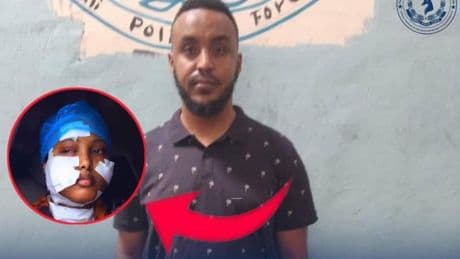 Nederlandse vrouw (27) ernstig verminkt in Somalië nadat ze weigert visum voor echtgenoot aan te vragen: ’Hij viel me plotseling aan’
