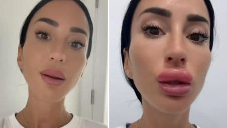Aurah Ruiz da el paso y dice adiós al relleno de sus labios: “Un día ya no me reconocía en el espejo”