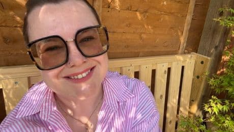 I’d accepted my shaved head – until I heard two women’s comments