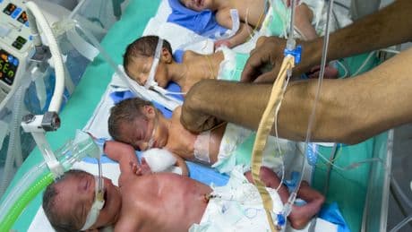 Muere desnutrido otro niño en Gaza, el cuarto en las últimas 48 horas