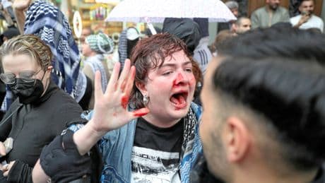 Demos | Polizeigewalt: Sehr sichtbar, aber ignoriert