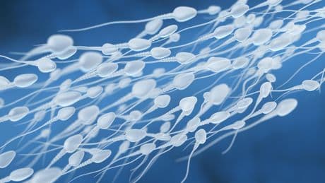 Contraception : en France, ces dizaines de milliers d’hommes qui choisissent la vasectomie