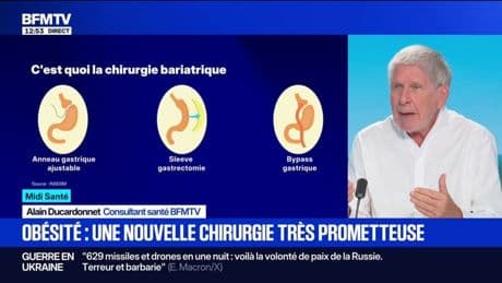 Une nouvelle chirurgie très prometteuse pour lutter contre l'obésité