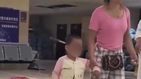 Una madre le clava "sin querer" un cuchillo de 15 cm a su hija de 3 años en la cabeza y luego se la lleva a pie al hospital