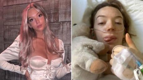 Brit, 23, trapped in US due to insurance after ‘life-changing’ fall at summer camp