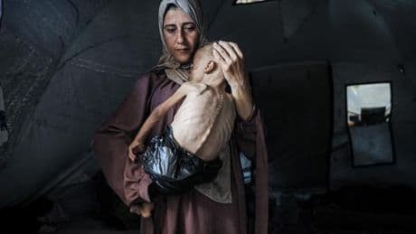 Dans la bande de Gaza, les ravages de la famine