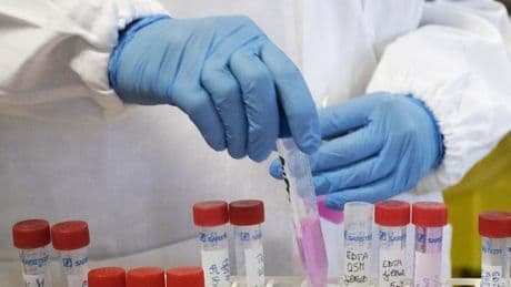 Tumori ereditari: in Italia oltre un milione a rischio, ma i test genetici non sono per tutti