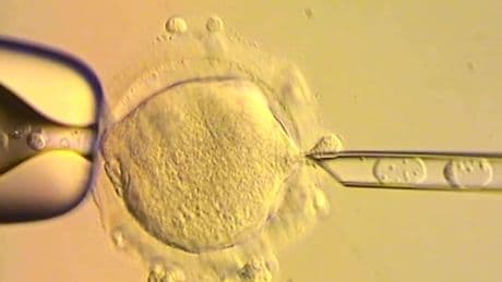 Babies born in UK with DNA from three people to treat inherited disease takes medicine into uncharted territory