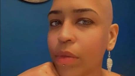 'I thought I just had toothache, then a shock diagnosis changed my life forever'