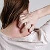 Subtle signs on your skin and neck that mean you could have deadly condition suffered by 100m