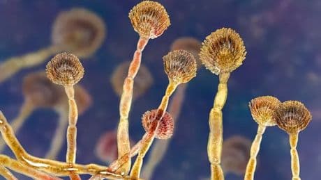 Inside 'killer fungus' plague that could cause millions of agonising deaths