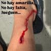 Athletic Bilbao star shows off horror gash as wild Lindelof challenge leaves him needing stitches after Man Utd clash