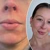 A cruel rash from a face cleaner marred my face. Three different GPs and three different treatments didn't help... then I found the answer that anyone who gets allergic reactions needs to know: CHARLOTTE VOSSAN