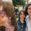 “Ze bleven slaan, tot ik bewusteloos was”: Tachku (21) zwaar toegetakeld bij homofobe aanval aan Zuidstation in Brussel