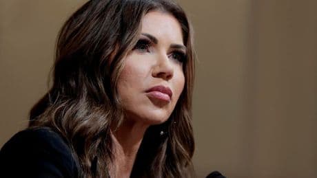 Kristi Noem Hospitalized After Allergic Reaction ‘Out Of An Abundance Of Caution’