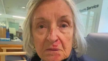 Gran left shaken and too scared to go out alone after horror fall at shopping centre