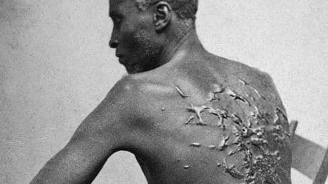 National park to remove exhibit of famed photograph showing former slave’s scarred back, says report