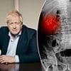 BORIS JOHNSON: I've just had private healthcare and here's why I'm not ashamed to admit it