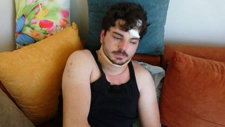 Feci şekilde dövülen oyuncu Mehmet Akif Akdeniz yaşadığı dehşeti anlattı