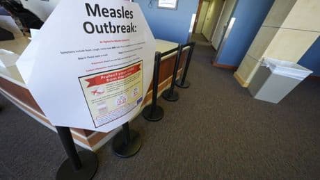 USA erleben schlimmste Masern-Epidemie seit 1992
