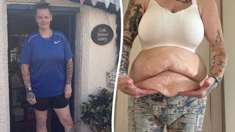 Mum lost 11st with Mounjaro - now she 'struggles to look at herself naked'