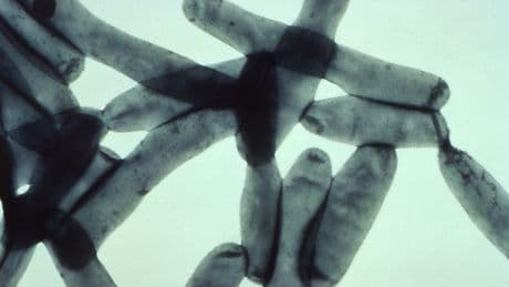 Legionnaires’ Disease Threatens NYC Again—Here’s What Causes It And Who’s Most At Risk