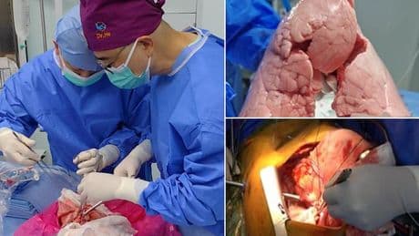 Scientists transplant a PIG lung into a human in world-first op: Organ remains viable for 9 days - paving the way for cross-species transplantation