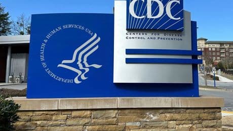 Cuts have eliminated more than a dozen US government health-tracking programs