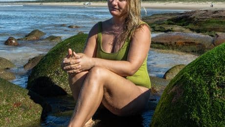 Bite Club: The Fraternity That Awaits You After a Shark Attack
