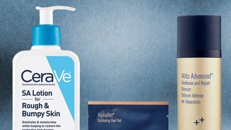SZA and Other Skin Experts Share Tips for Emergency Acne Relief
